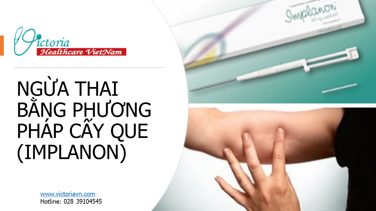 PHƯƠNG PHÁP TRÁNH THAI BẰNG QUE CẤY (IMPLANON) | Thư Viện Sức Khỏe