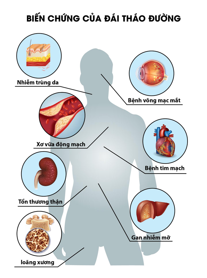 Giúp bạn giải đáp các thắc mắc về Bệnh Đái Tháo Đường7