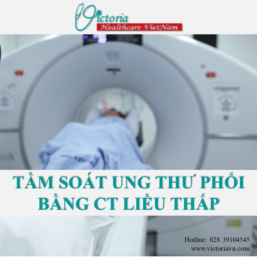 TẦM SOÁT UNG THƯ PHỔI BẰNG CT LIỀU THẤP